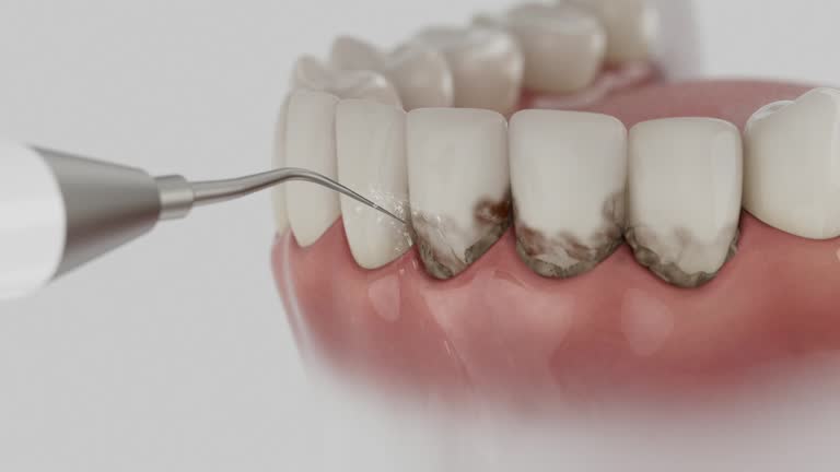 Trusted Dental Implants service in White Oak, TX - Dentist Open Now